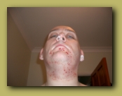 As baldness sets in I decided to start Shaving
Need more Practice !!!

October 2005